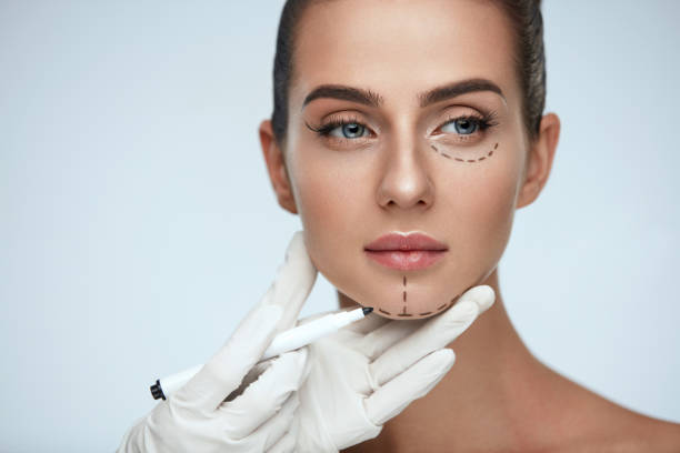 Harmonização facial com botox